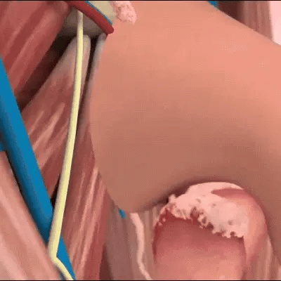 MaxProst™ ג'ל | משפר חשק מיני וטיפול בבלוטת הערמונית