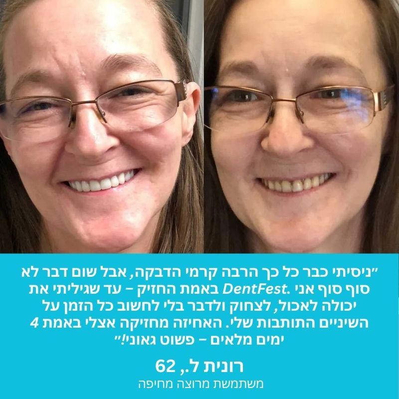 DentFest™ | רצועת אחיזה תרמופלסטית לשיניים תותבות