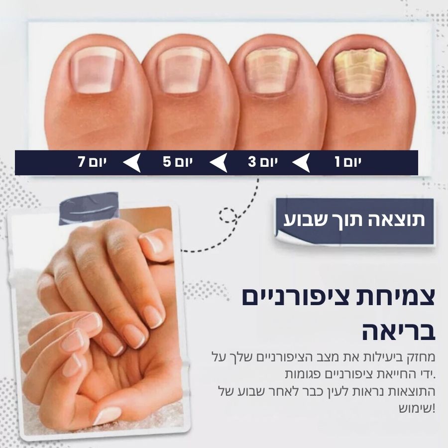 SwiftNail™ | סרום לתיקון וחיזוק הציפורניים