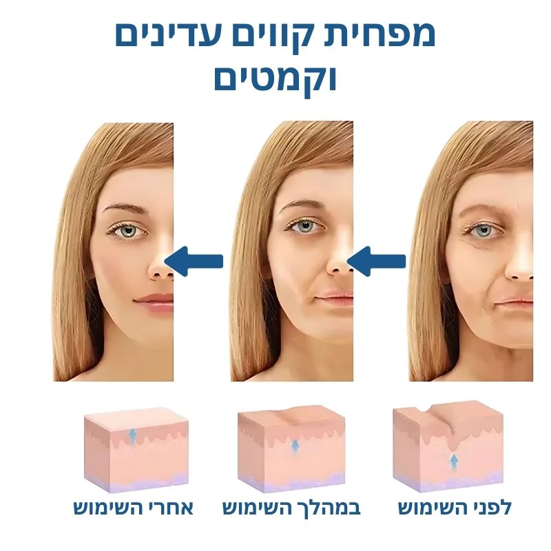 YoungSkin™ | פאצ'ים טרנסדרמליים לאנטי-אייג'ינג