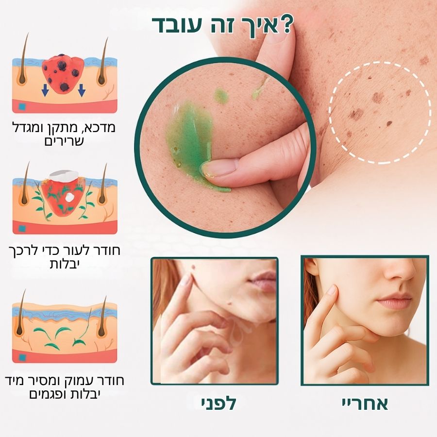 PerfekteHaut™ | ג'ל מיידי להסרת שומות וכתמים