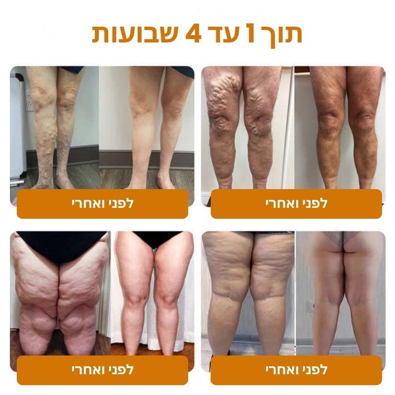 CoreFlex™ | רפידת EMS לאימון שרירי הבטן